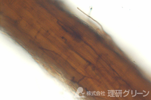 根に感染したサマーパッチ病 病原菌の菌糸