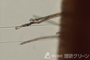 斑点病菌の分生子柄