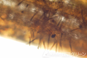 褐斑病の分生子と分生子柄