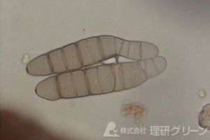 褐斑病 病原菌の分生子