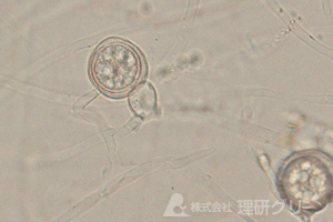 赤焼病の卵胞子・造卵器・造精器